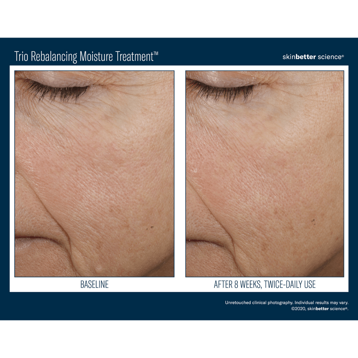 Skinbetter ScienceSkinbetter Science Trio Rebalancing Moisture Treatment 50mlSkinShop