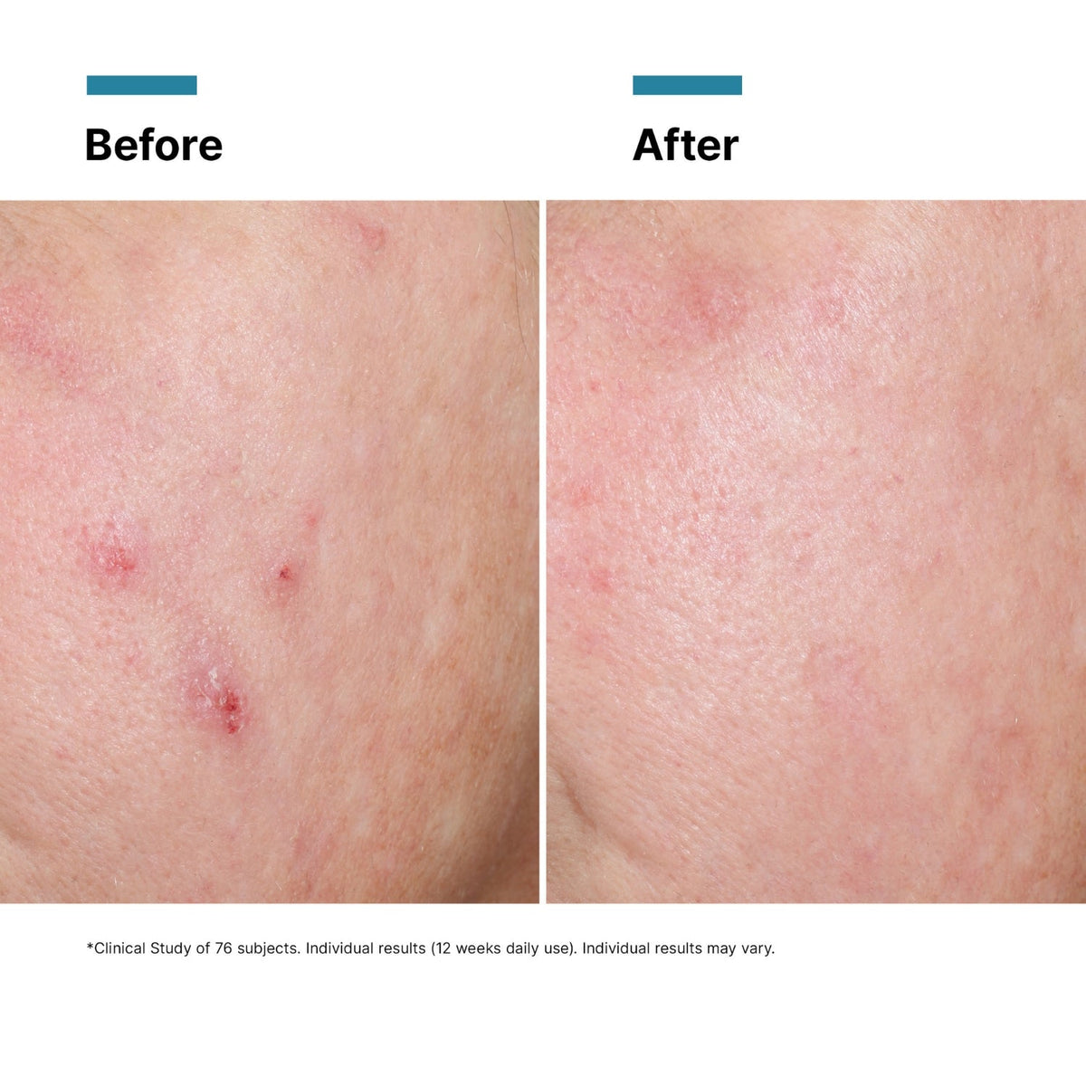SkinCeuticalsSkinCeuticals Advanced RGN-6 50mlSkinShop