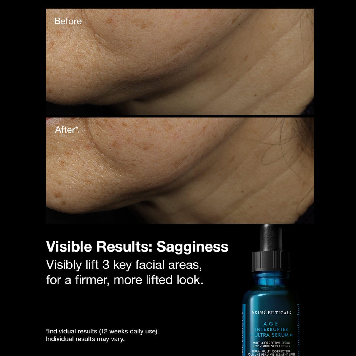 SkinCeuticalsSkinCeuticals A.G.E Interrupter Ultra Serum 30mlSkinShop