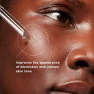 SkinCeuticalsSkinCeuticals Blemish + Age Defense Serum 30mlSkinShop