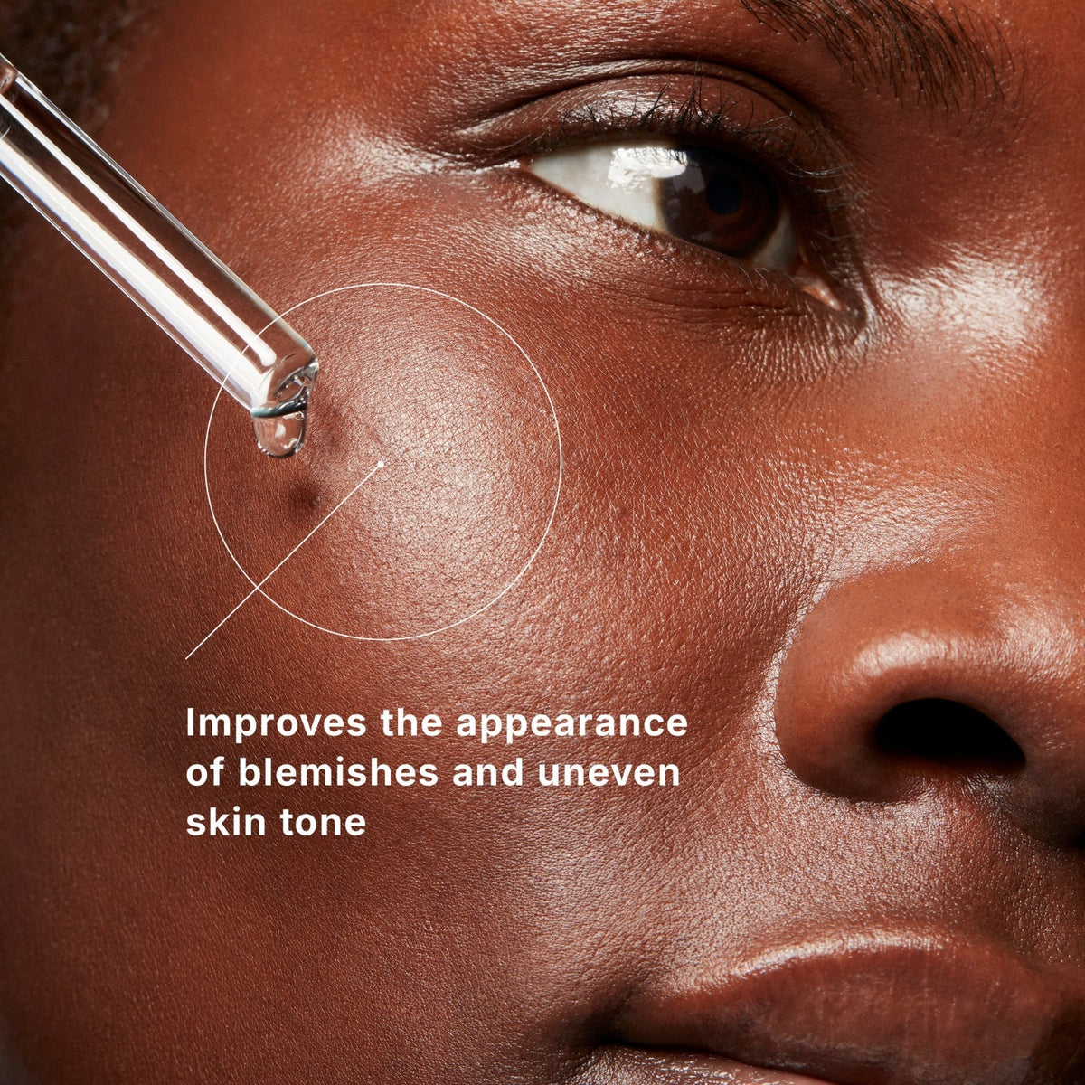 SkinCeuticalsSkinCeuticals Blemish + Age Defense Serum 30mlSkinShop