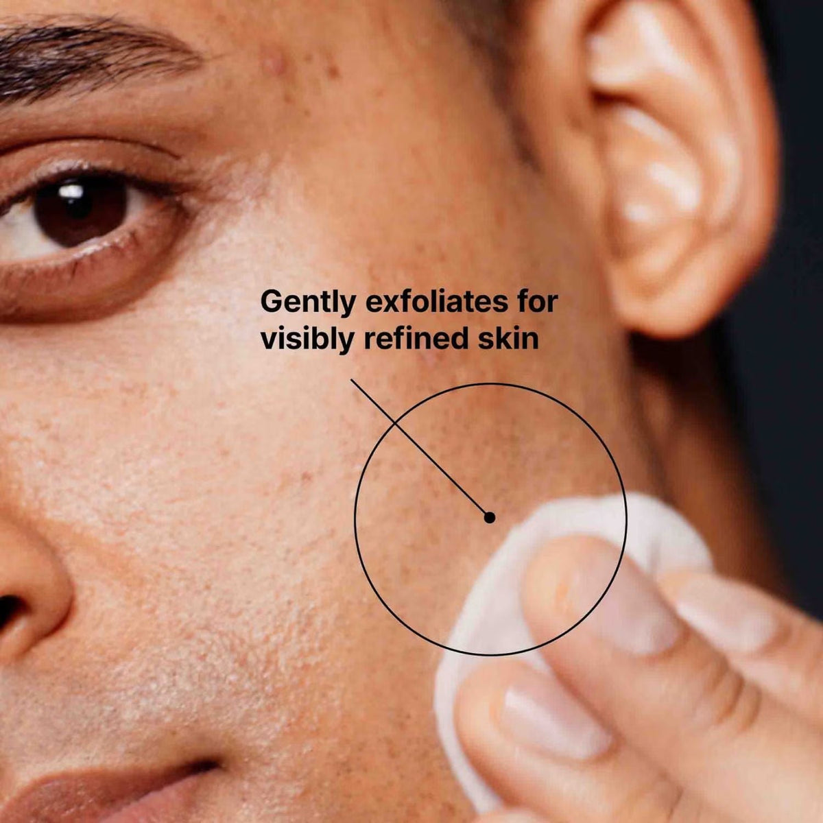 SkinCeuticalsSkinCeuticals Blemish + Age Toner 200mlSkinShop