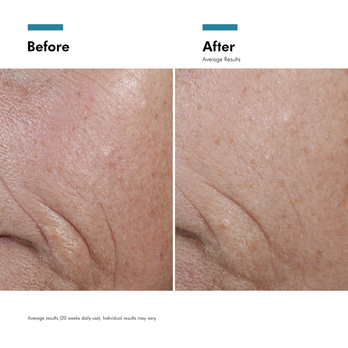 Before and after close up of skin showing fewer fine lines after using C E Ferulic