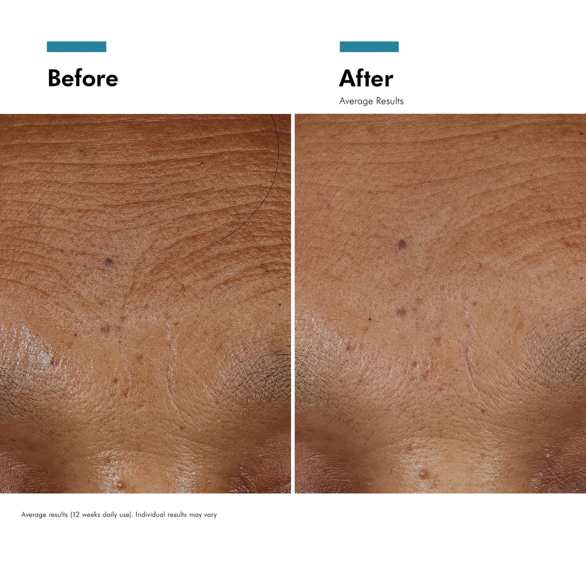 SkinCeuticalsSkinCeuticals HA Intensifier Multi-Glycan 30mlSkinShop