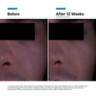SkinCeuticalsSkinCeuticals P-TIOX Anti-Wrinkle Cream 48mlSkinShop