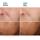 SkinCeuticalsSkinCeuticals Phloretin CF 30mlSkinShop