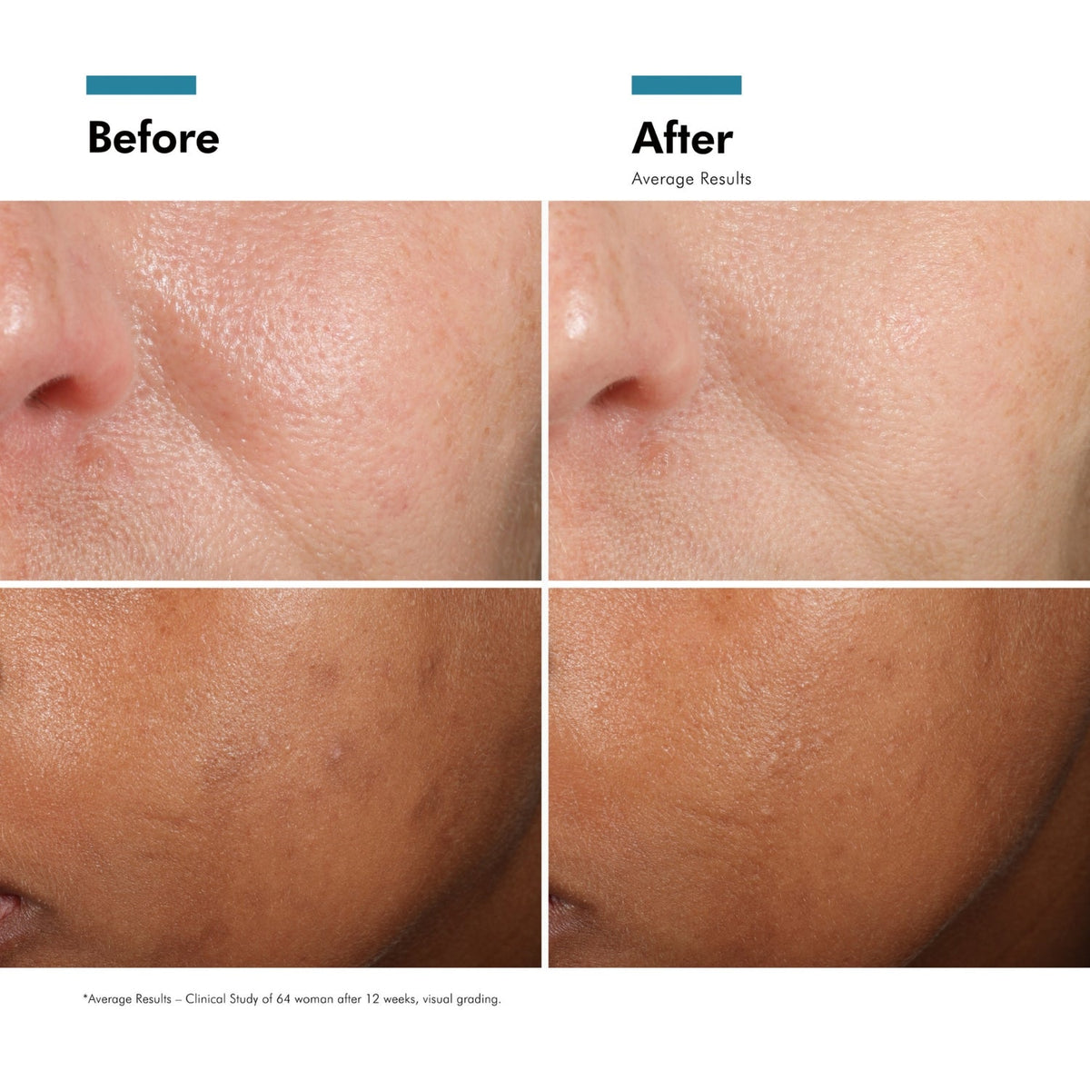 SkinCeuticalsSkinCeuticals Phloretin CF 30mlSkinShop