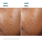 SkinCeuticalsSkinCeuticals Phyto A+ Brightening Treatment 30mlSkinShop