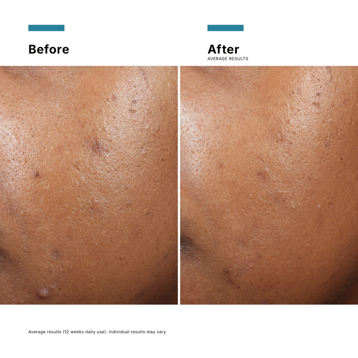 SkinCeuticalsSkinCeuticals Phyto A+ Brightening Treatment 30mlSkinShop
