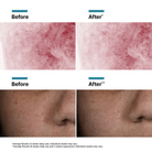 SkinCeuticalsSkinCeuticals Phyto Corrective with PDRN from Biotech Serum 30mlSkinShop