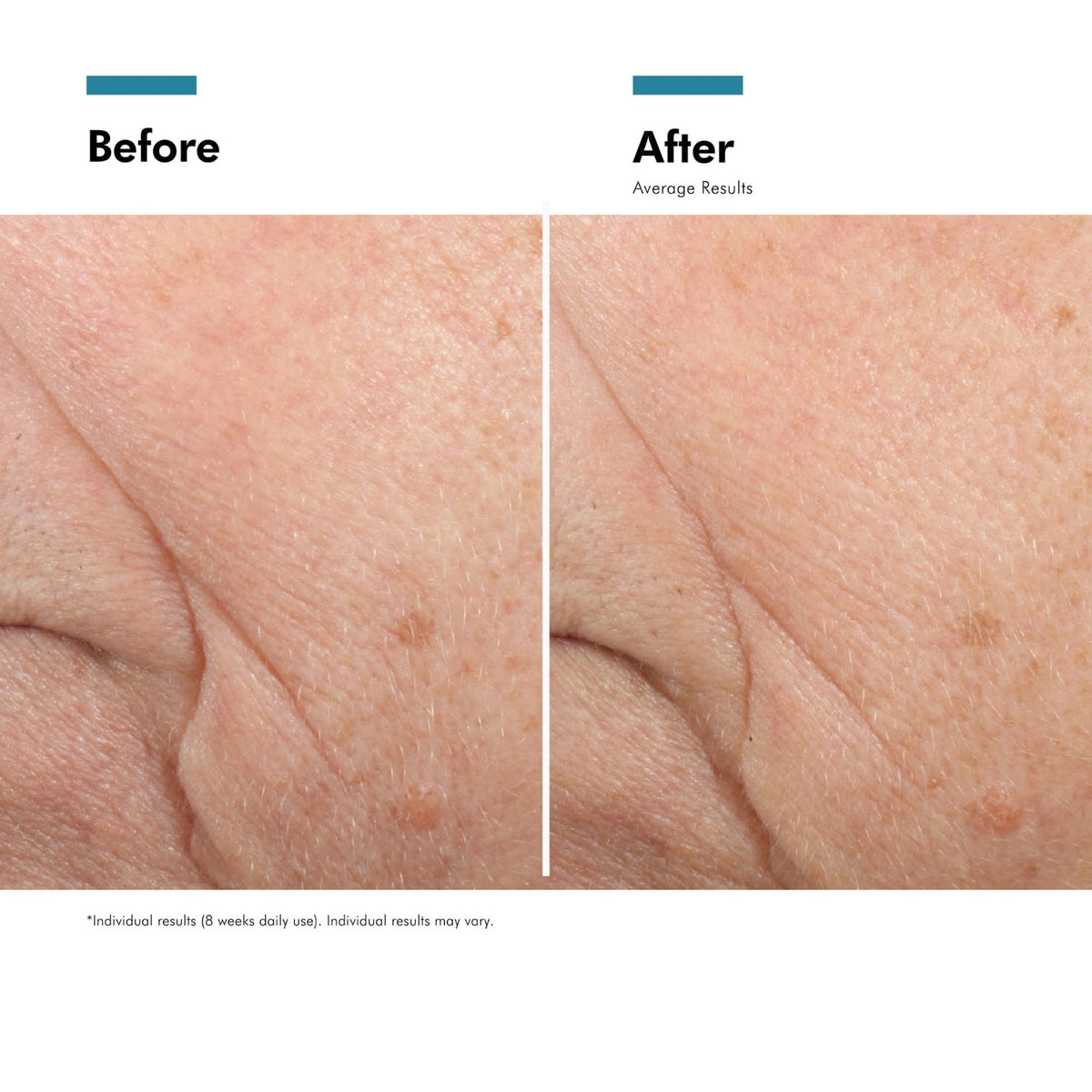 SkinCeuticalsSkinCeuticals Triple Lipid Restore 2:4:2 48mlSkinShop