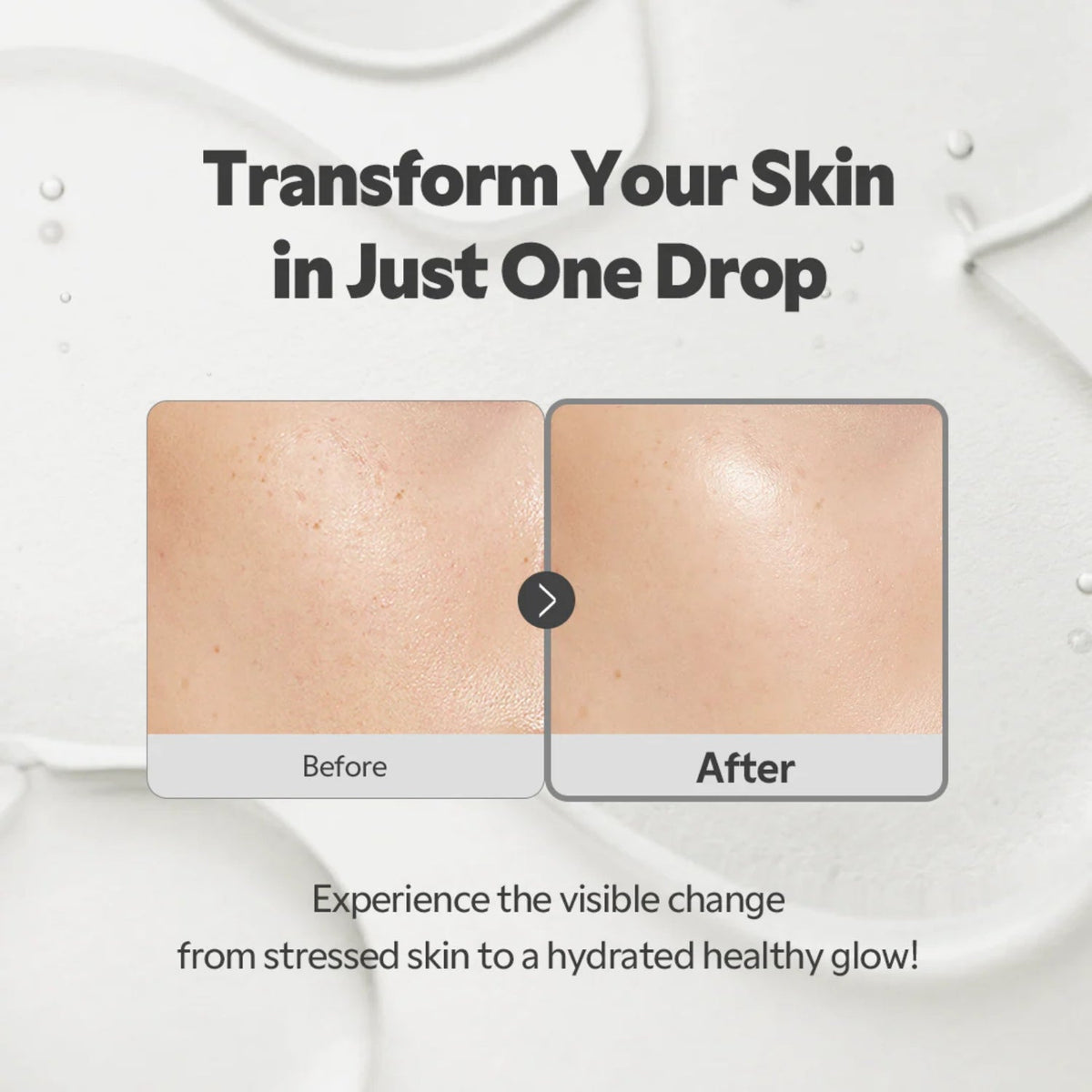 TIRTIR SOS Serum 50ml SkinShop
