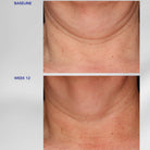 ZO Skin HealthZO Skin Health Neck Complex 50mlSkinShop