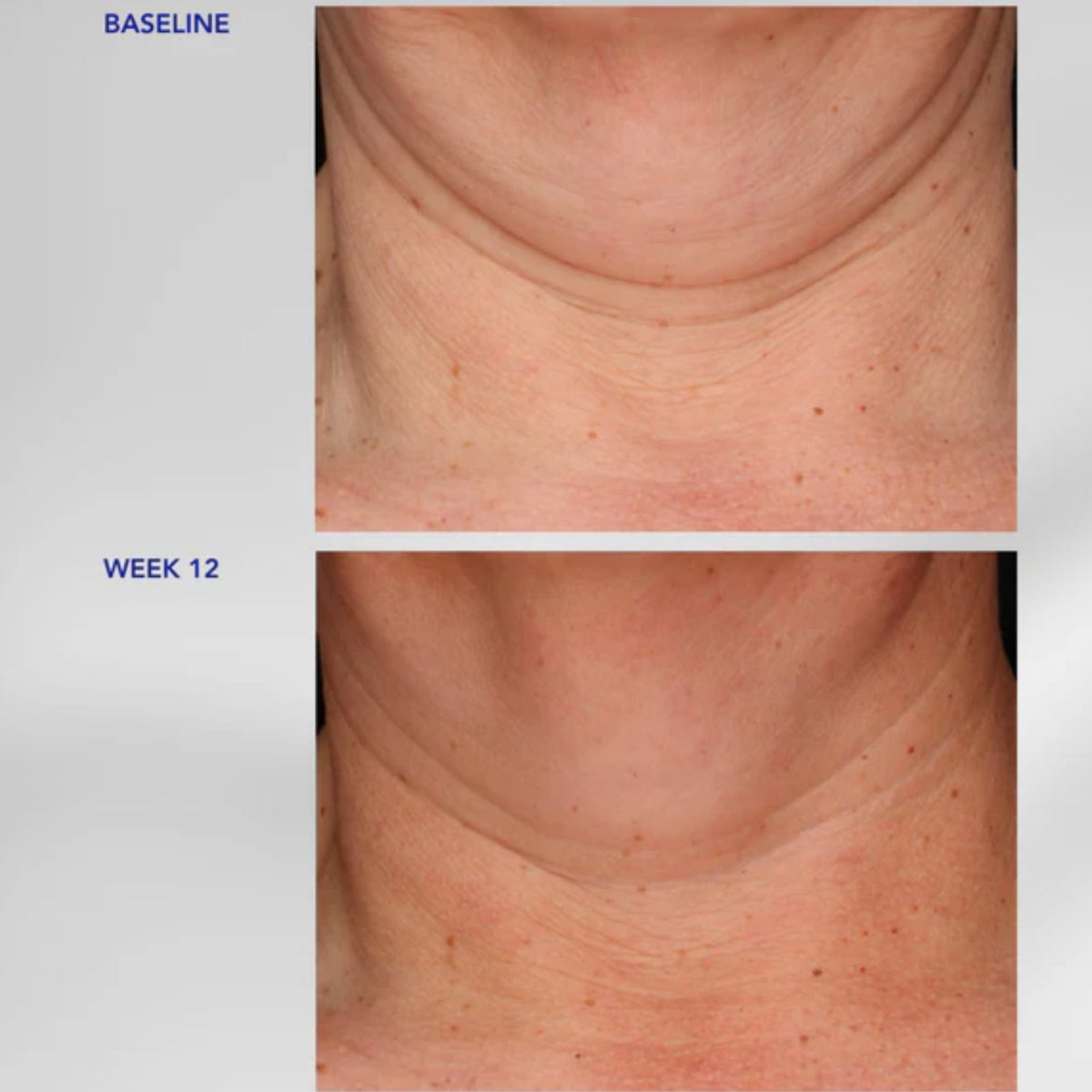 ZO Skin HealthZO Skin Health Neck Complex 50mlSkinShop