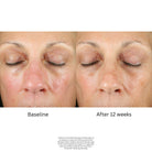ZO Skin HealthZO Skin Health Renewal Crème 50mlSkinShop