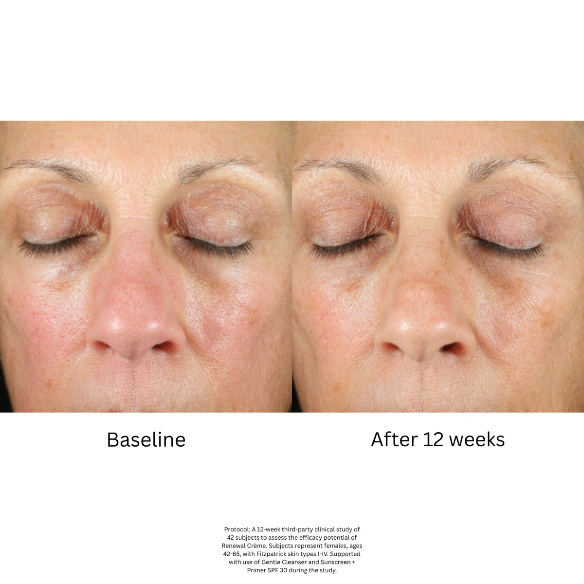 ZO Skin HealthZO Skin Health Renewal Crème 50mlSkinShop