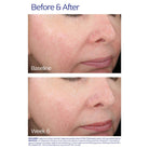 ZO Skin HealthZO Skin Health Rozatrol 50mlSkinShop