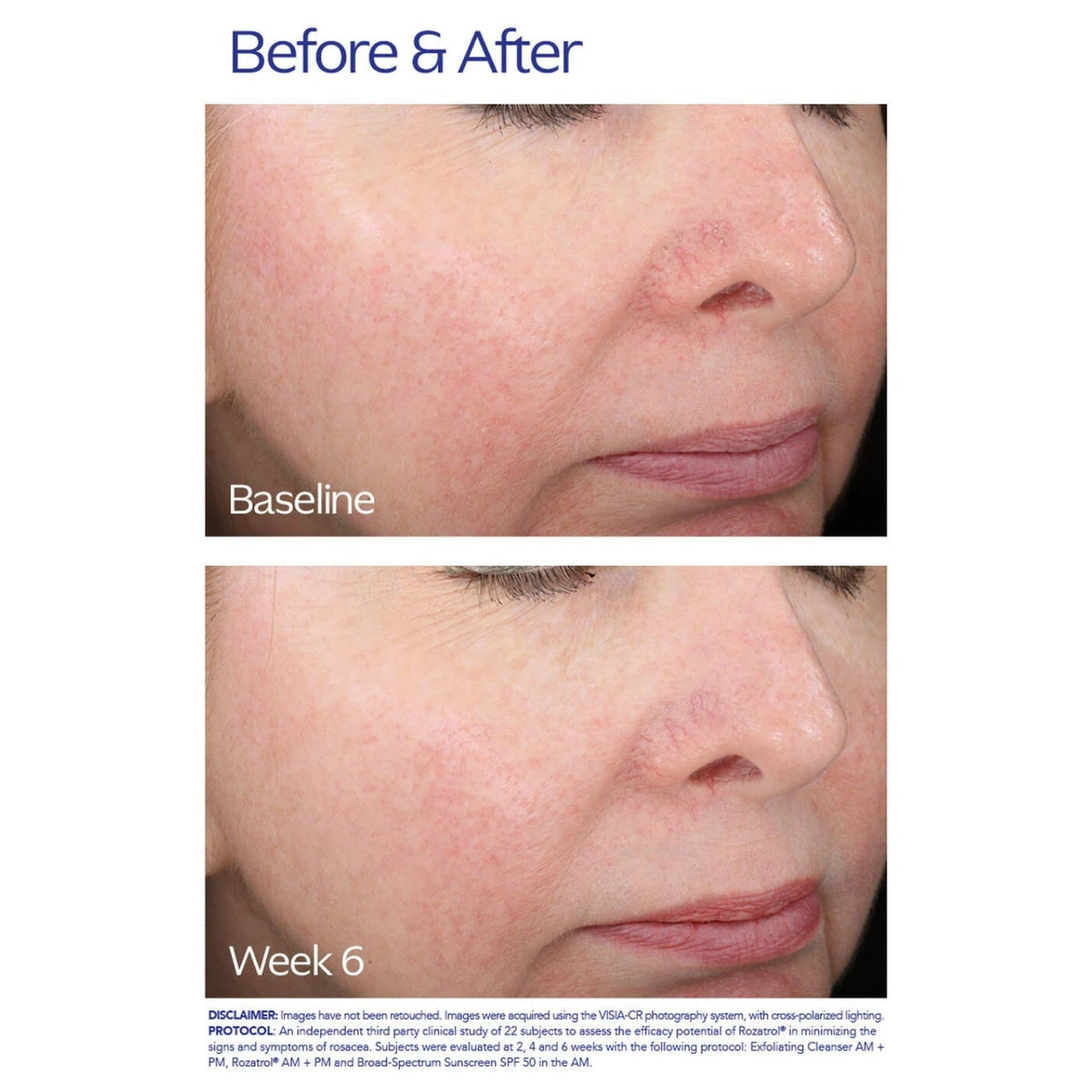 ZO Skin HealthZO Skin Health Rozatrol 50mlSkinShop