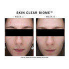 Advanced Nutrition Programme Advanced Nutrition Programme | Skin Clear Biome | 60 caps - SkinShop