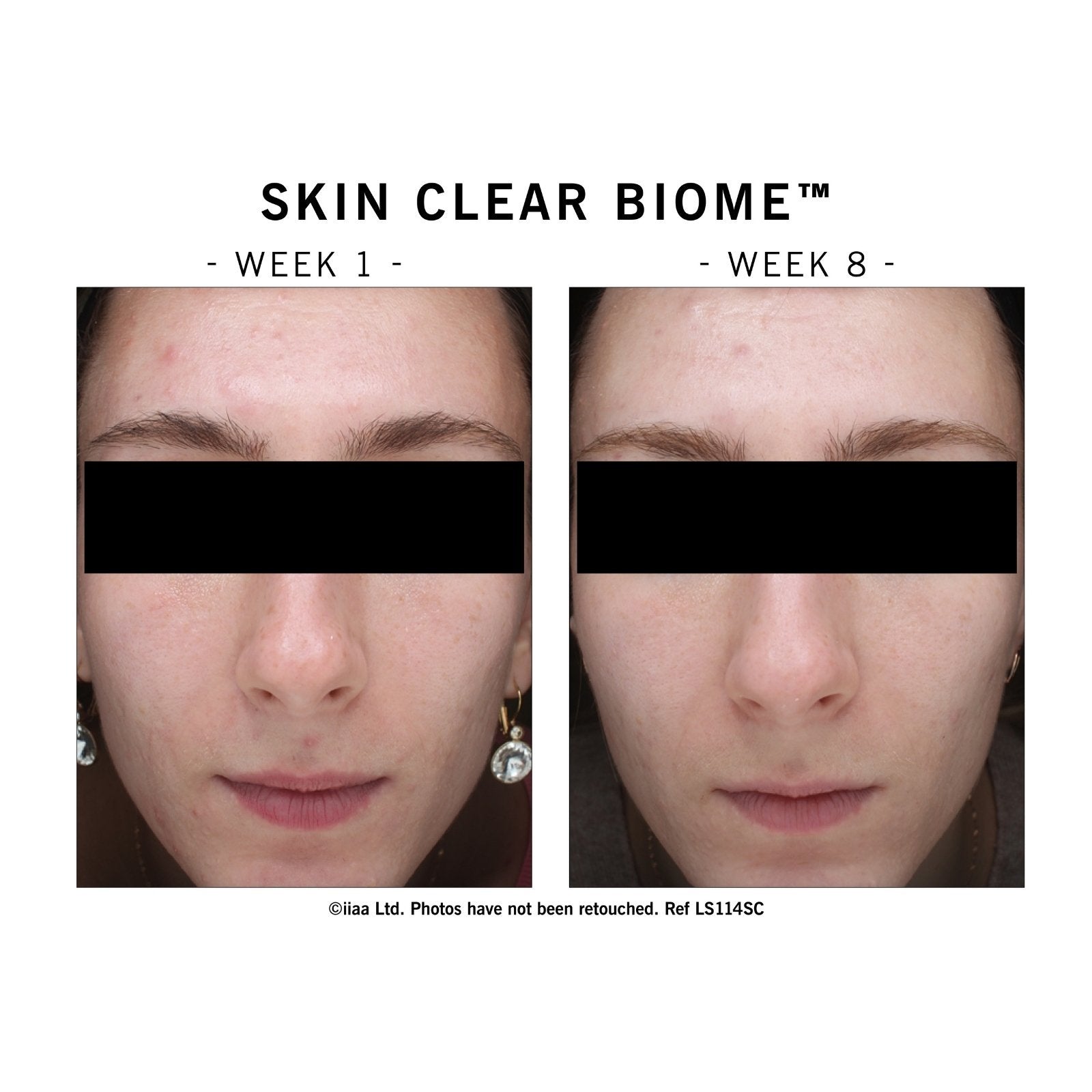 Advanced Nutrition Programme Advanced Nutrition Programme | Skin Clear Biome | 60 caps - SkinShop