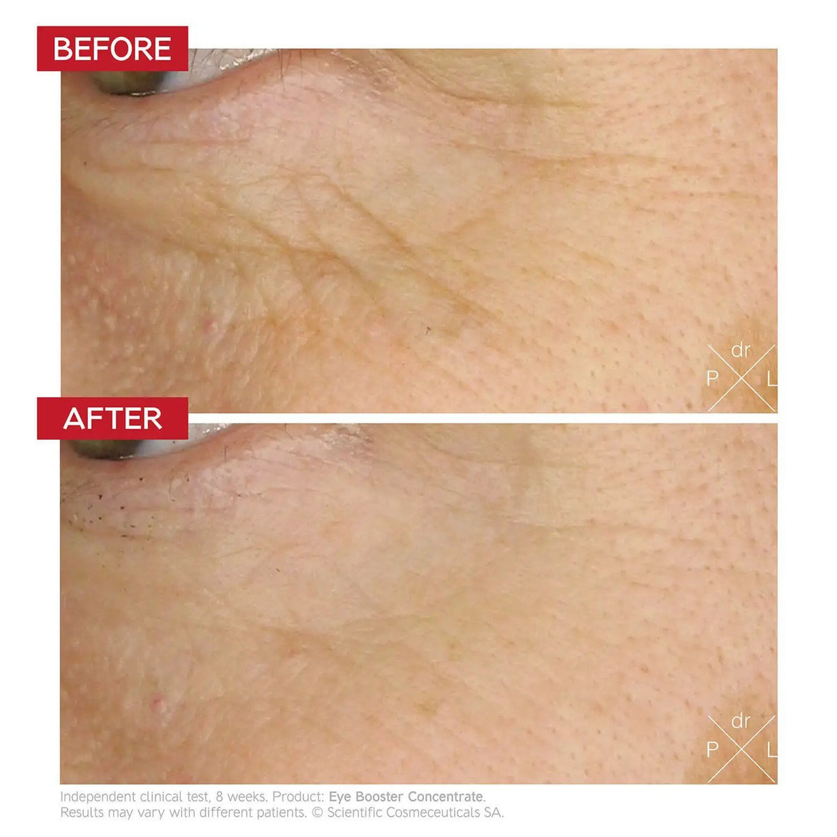 Dr Levy Switzerland Dr LEVY Switzerland | Eye Booster Concentrate - SkinShop