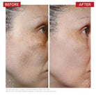 Dr Levy Switzerland Dr LEVY Switzerland | Radical3 Reboot Pro Peel - SkinShop
