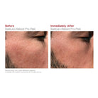Dr Levy Switzerland Dr LEVY Switzerland | Radical3 Reboot Pro Peel - SkinShop