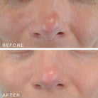 Medik8 Medik8 | Crystal Retinal 10 - SkinShop