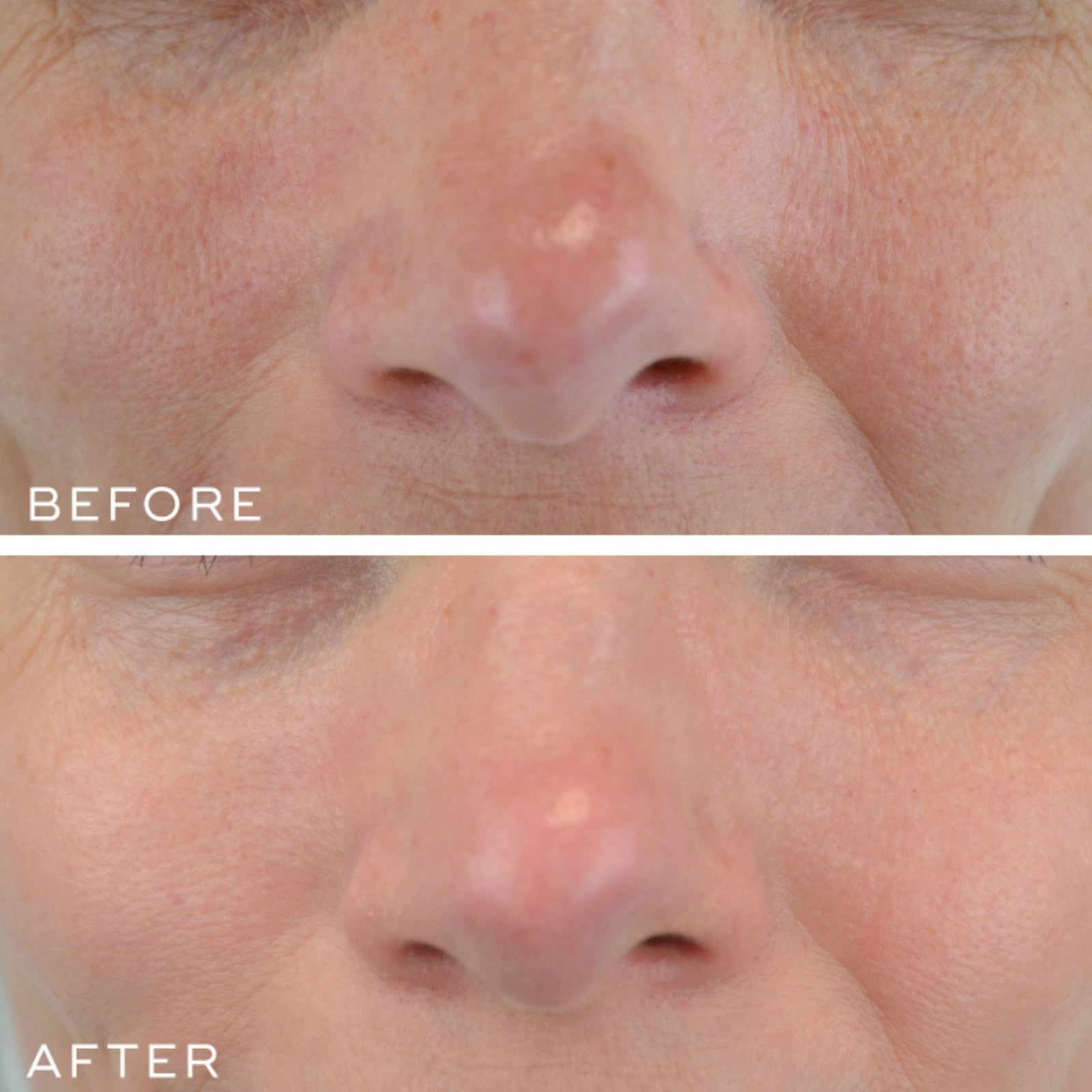Medik8 Medik8 | Crystal Retinal 10 - SkinShop