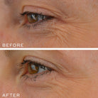 Medik8 Medik8 | Crystal Retinal 10 - SkinShop