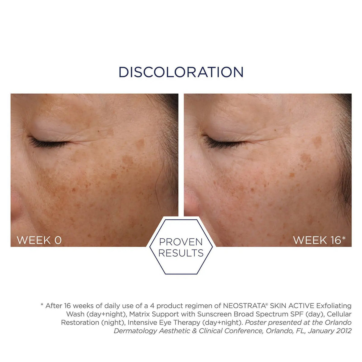 Neostrata Neostrata | Repair Exfoliating Wash - SkinShop