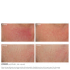 SkinCeuticals | Glycolic 10 Renew Overnight - SkinShop