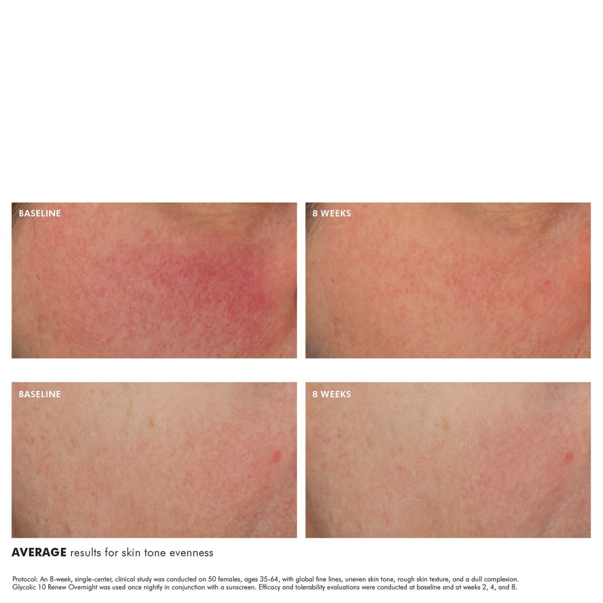 SkinCeuticals | Glycolic 10 Renew Overnight - SkinShop