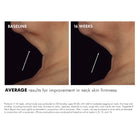 SkinCeuticals SkinCeuticals | Tripeptide-R Neck Repair - SkinShop