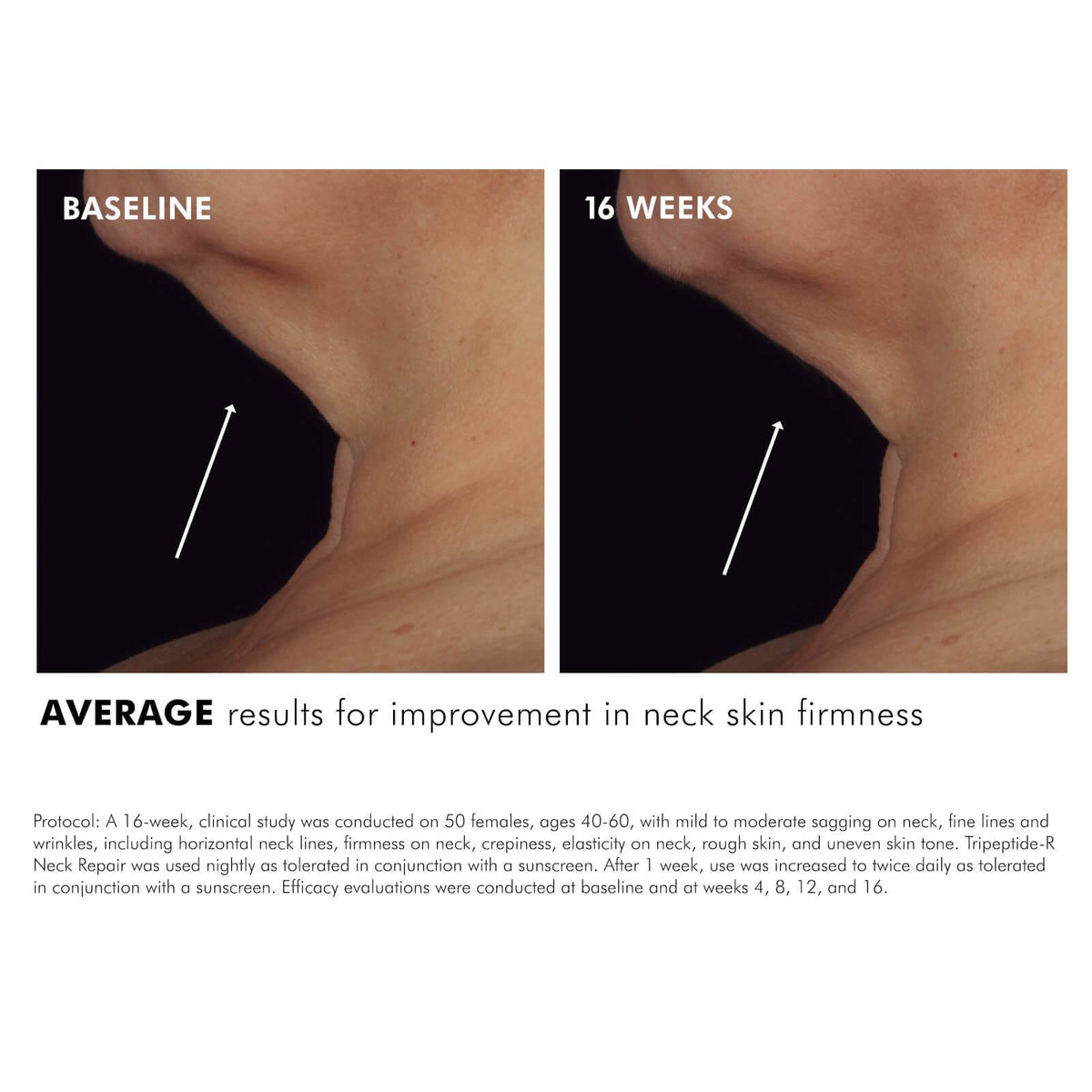 SkinCeuticals SkinCeuticals | Tripeptide-R Neck Repair - SkinShop