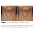 SkinCeuticals SkinCeuticals | Tripeptide-R Neck Repair - SkinShop