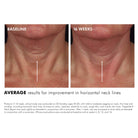SkinCeuticals SkinCeuticals | Tripeptide-R Neck Repair - SkinShop