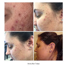 Thoclor Labs ThoClor Labs | GF2 Skin Rejuvenation - SkinShop