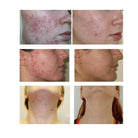 Advanced Nutrition Programme Advanced Nutrition Programme | Skin Accumax | 60 caps - SkinShop