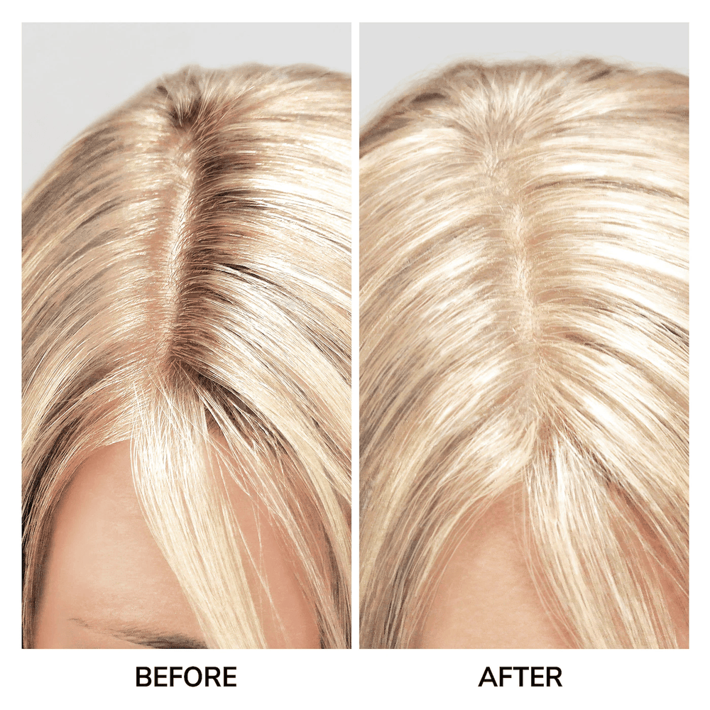 Root Cover Up
