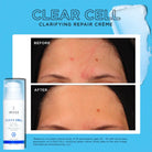 Image Skincare Image Skincare | Clear Cell clarifying repair crème | 50ml - SkinShop
