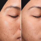 Medik8 Medik8 | Press & Clear | 200ml - SkinShop