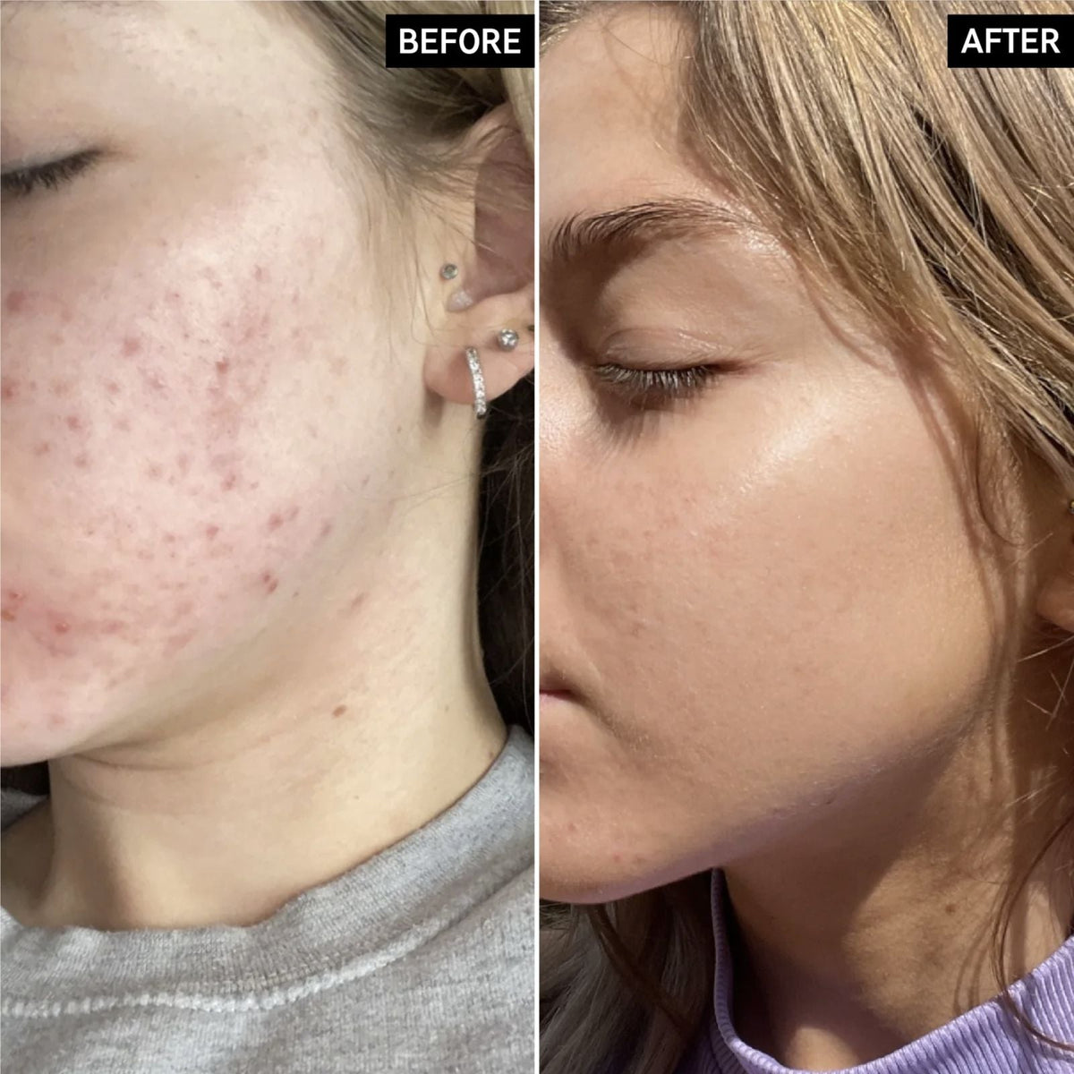 The Inkey List The Inkey List | BHA Serum | 30ml - SkinShop