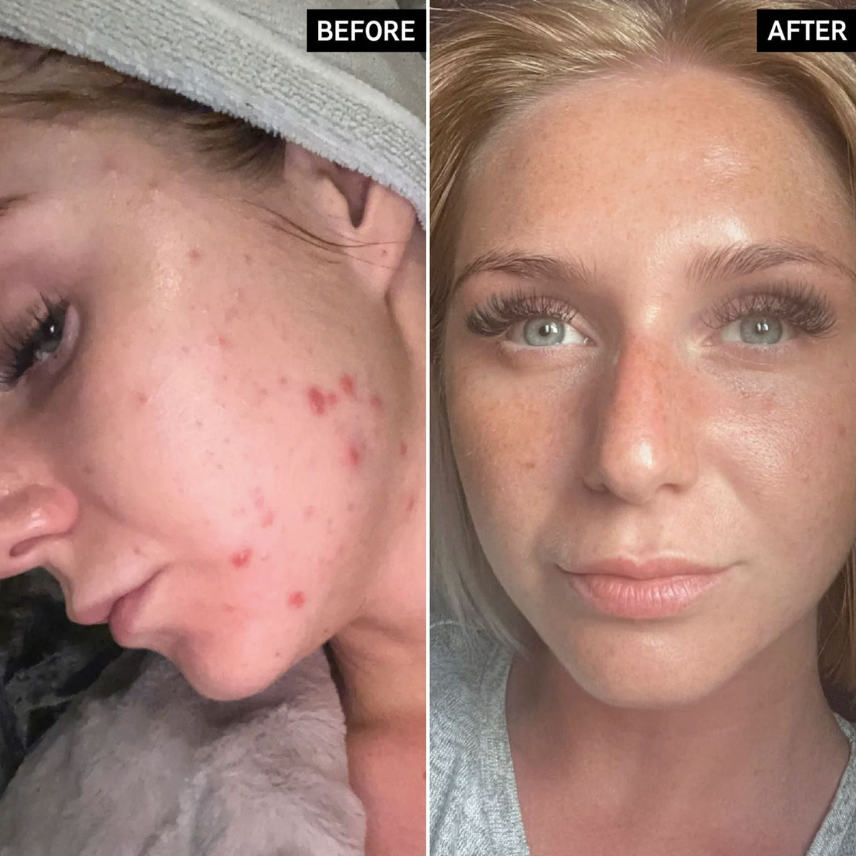 The Inkey List The Inkey List | BHA Serum | 30ml - SkinShop